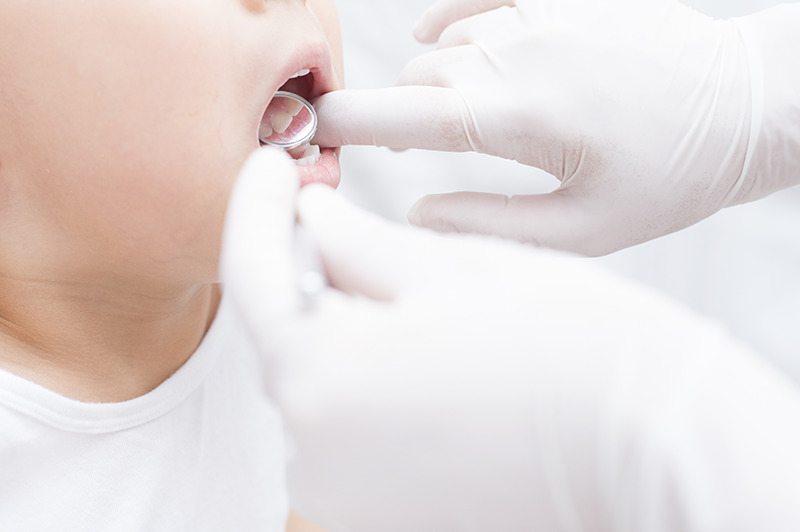 歯の検査2